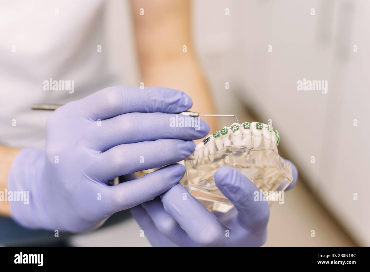 The dentist shows an artificial model of the jaw with braces. How to