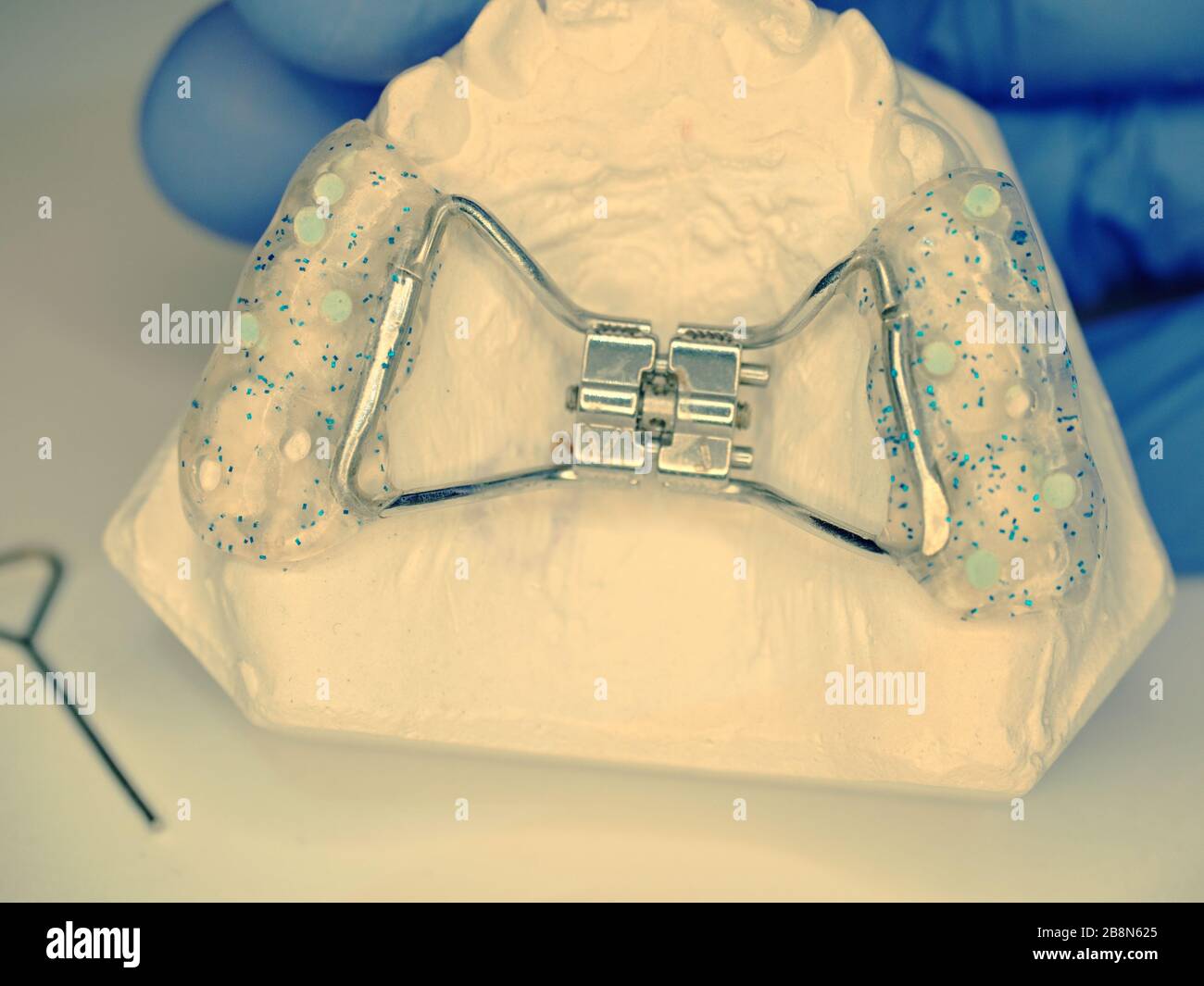 Rapid palatal expander set on gypsum teeth cast check by dentist
