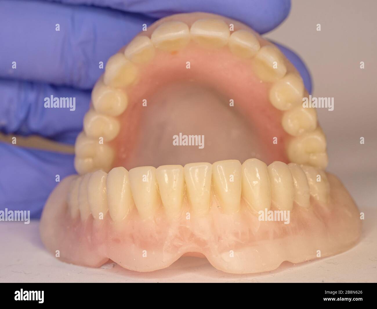 Complete acrylic dental prosthesis with metal retaining base Stock