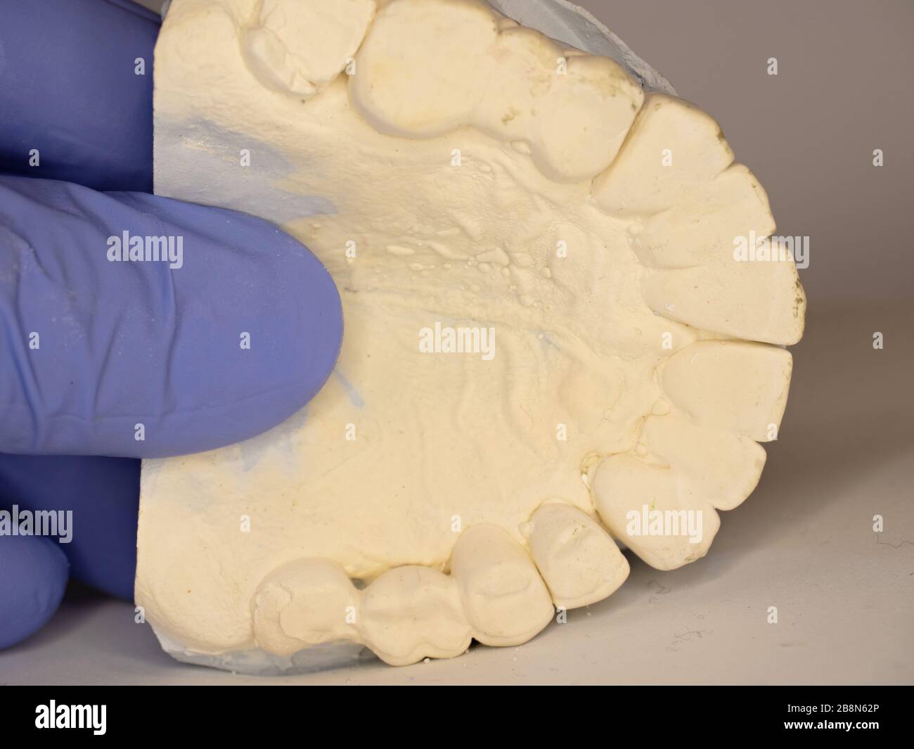 Denture gypsum teeth model. Upper palate of dentist laboratory patient