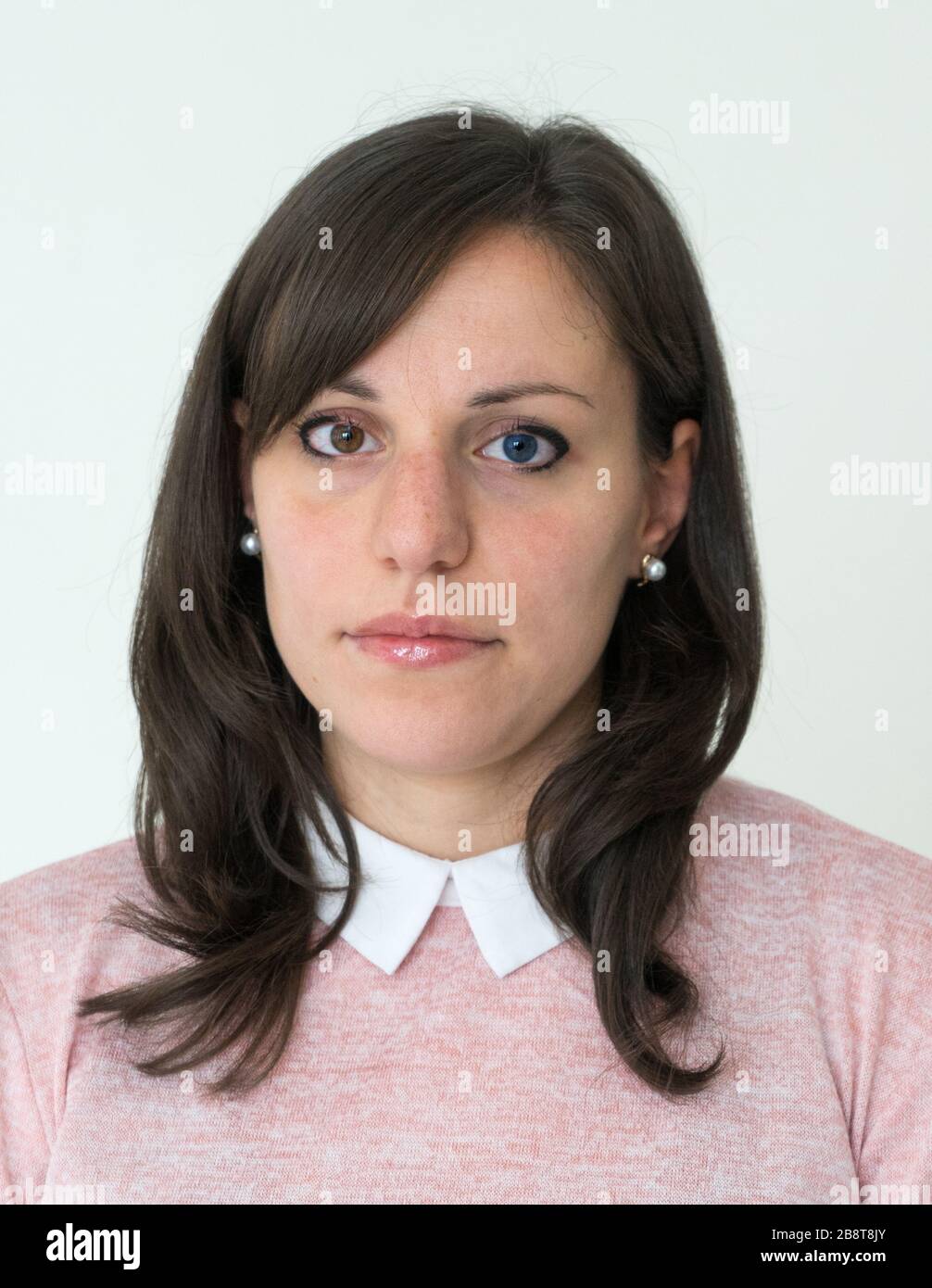 Heterochromia. Young caucasian woman with different colored pupils poses on white background. Brown and blue. Stock Photo