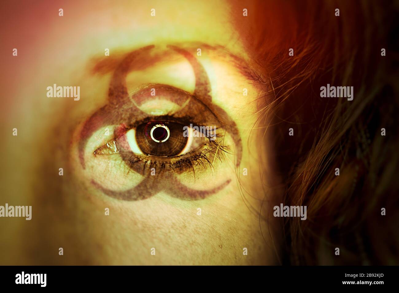 FOTOMONTAGE, Biogefährdungszeichen im Gesicht einer Frau, Symbolfoto Coronavirus Stock Photo