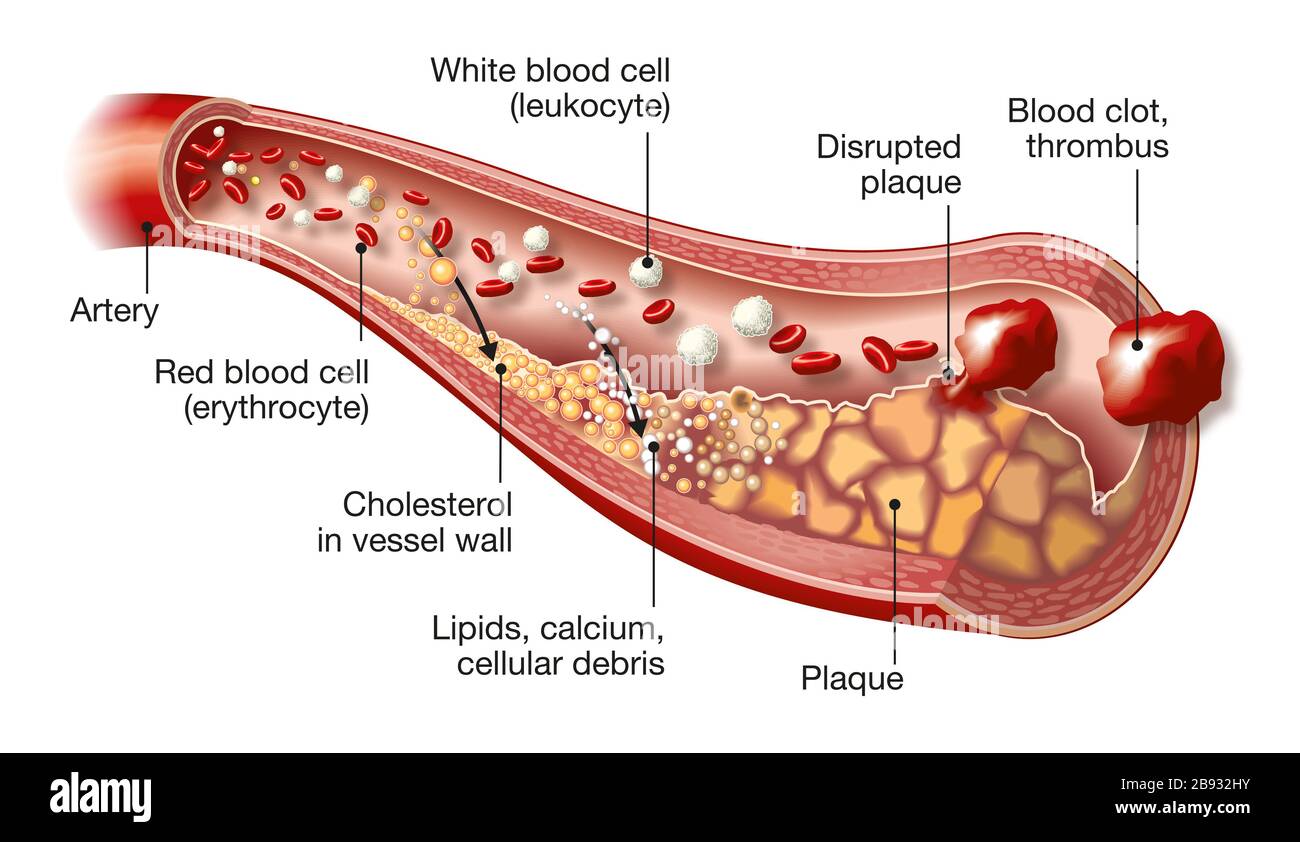 3D illustration showing artery with white and red blood cells