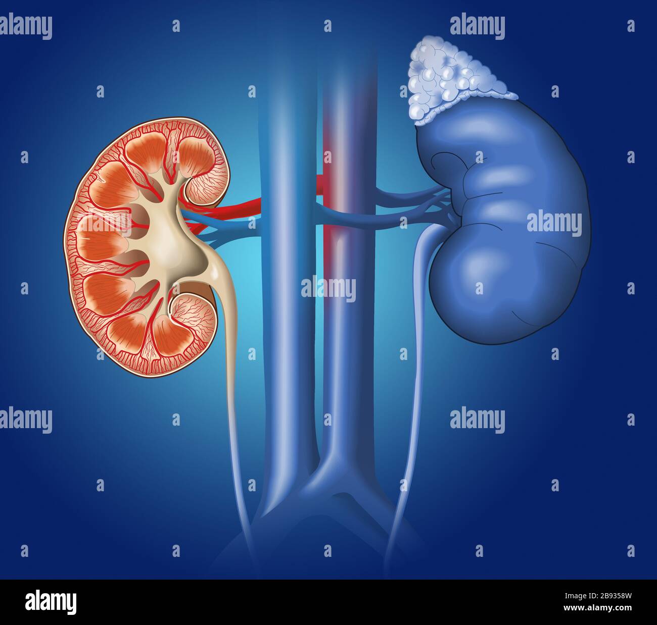 Medically illustration showing cross-section of a kidney with with inferior vena cava and descending aorta on blue background Stock Photo