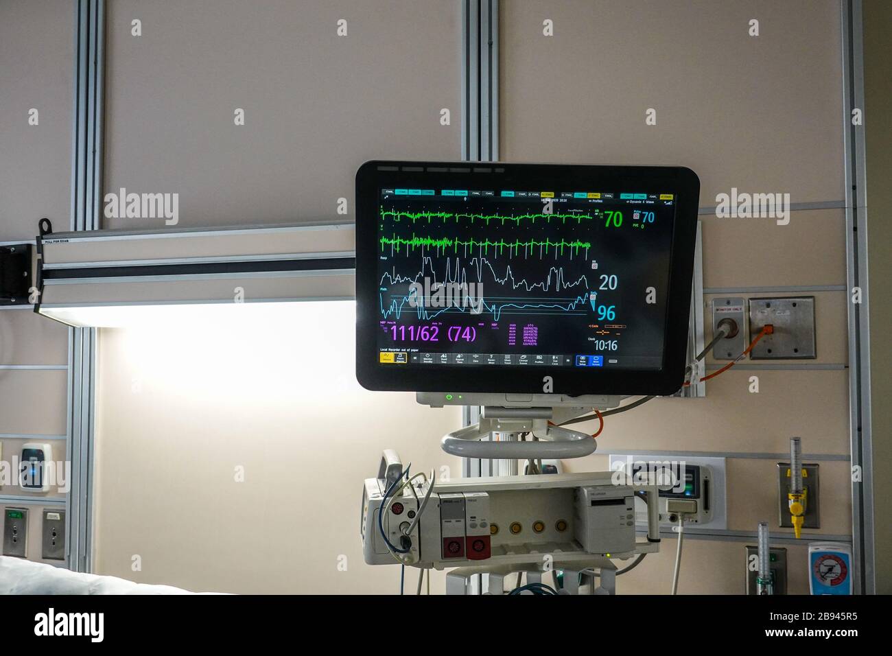 Ekg Monitor Patient High Resolution Stock Photography And Images Alamy