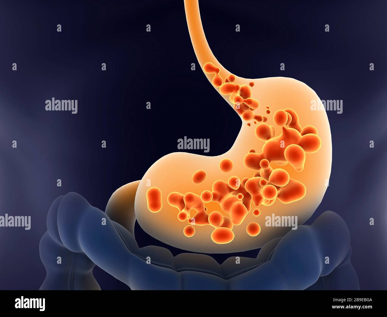 Medical illustration of acid reflux in human stomach Stock Photo Alamy