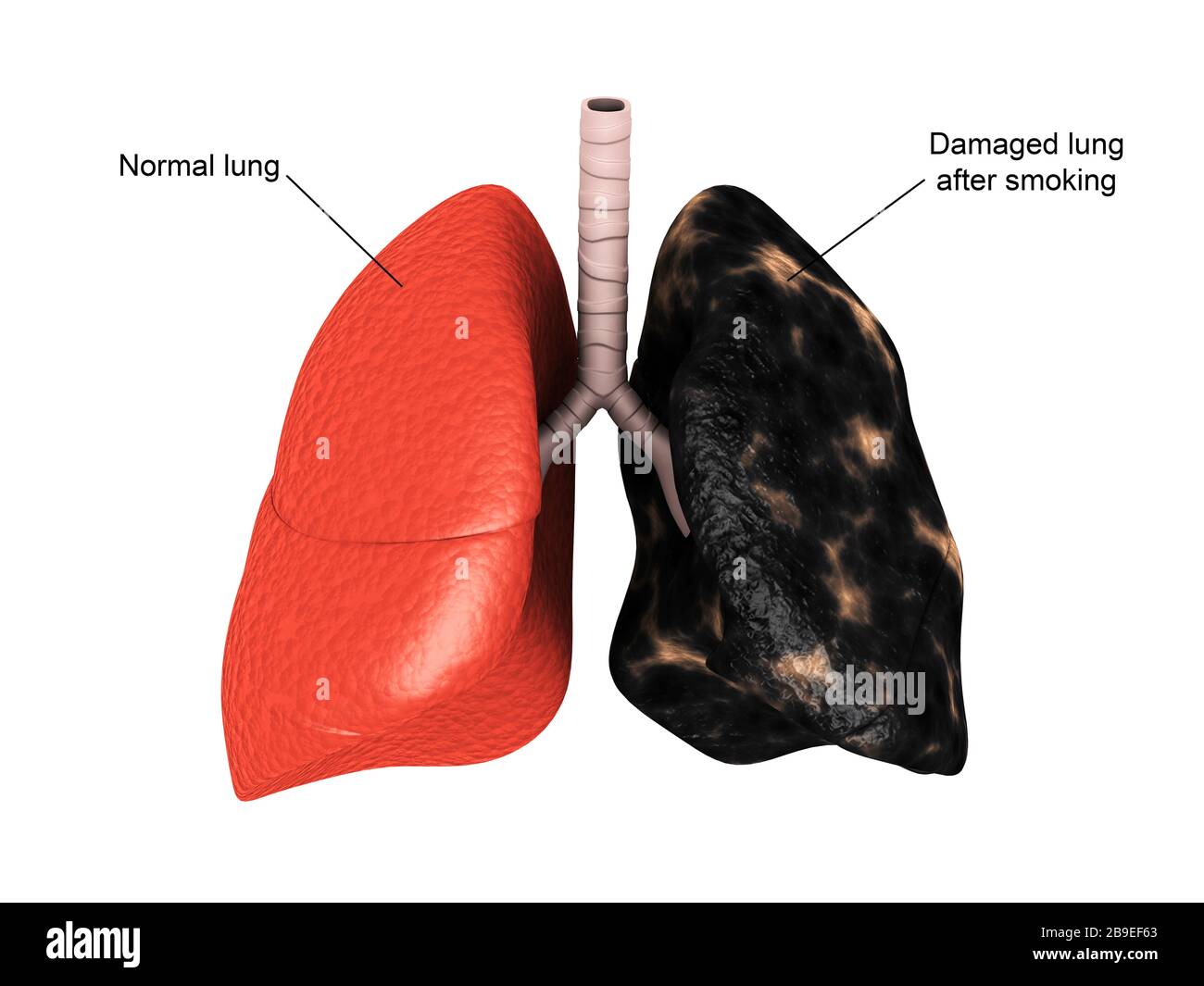 Comparison of a healthy lung vs. a smoker's lung. Stock Photo