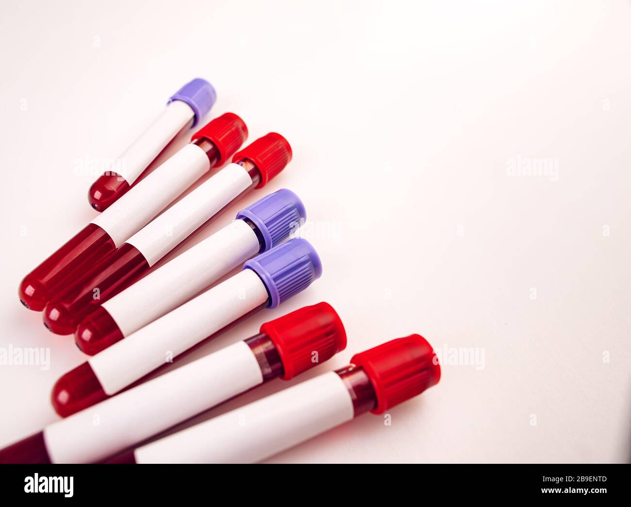Sample blood collection tubes with empty test label Stock Photo Alamy