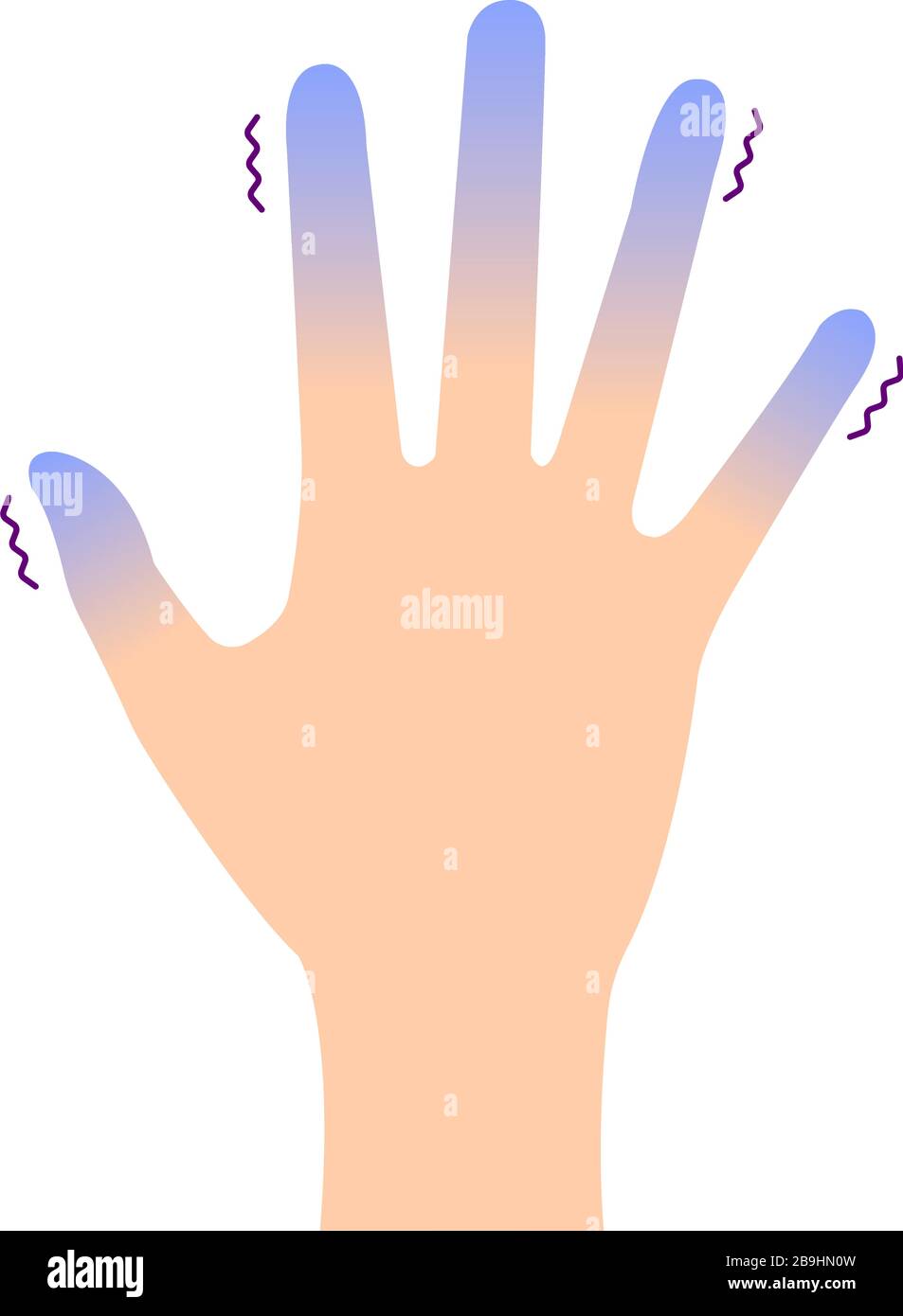 Cold hand blood circulation illustration (sensitivity to cold, cold