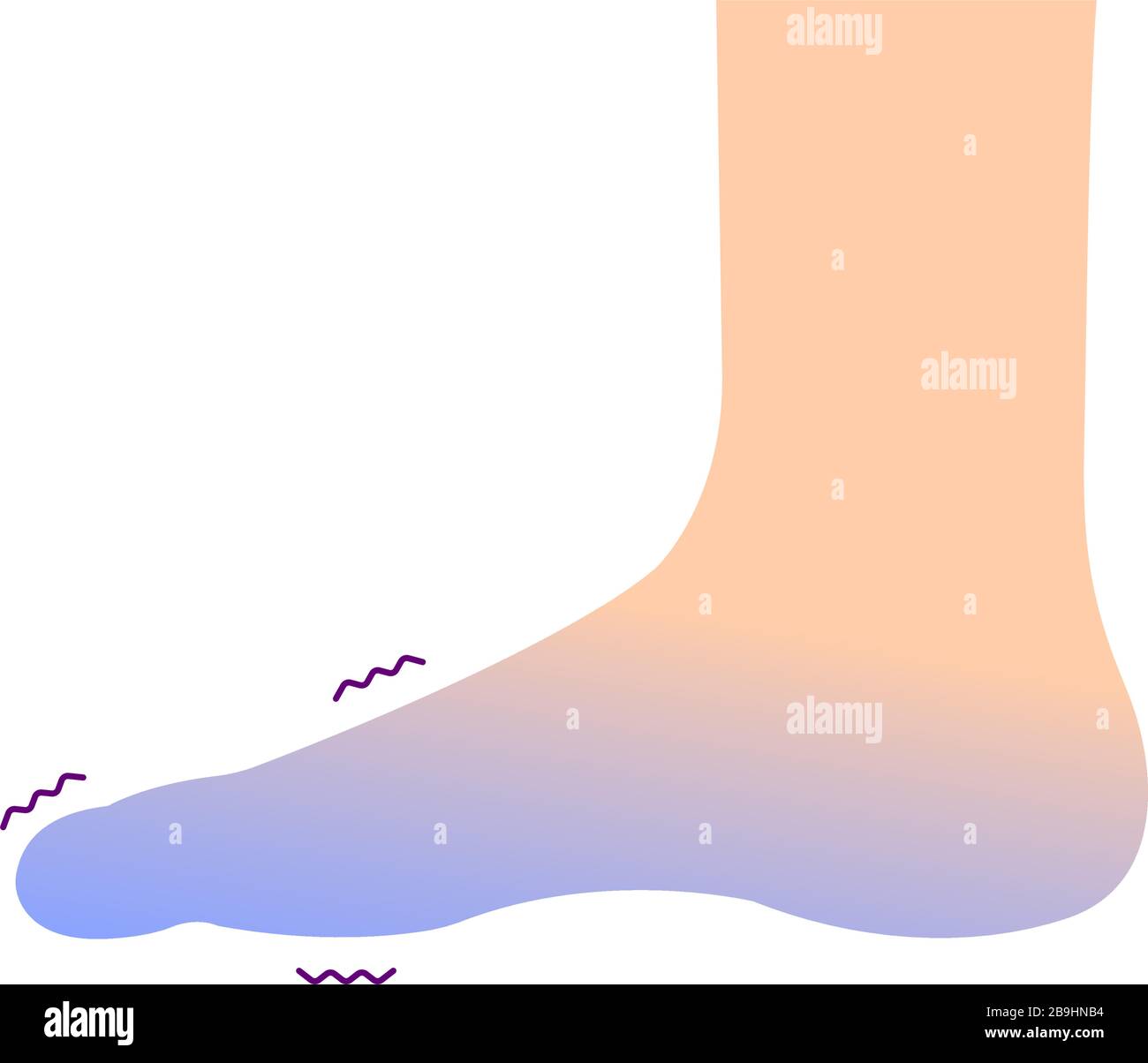 Cold hand blood circulation illustration (sensitivity to cold, cold ...