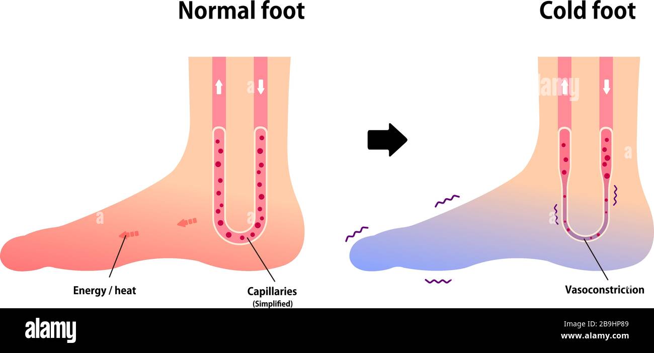 Blood Circulation Foot High Resolution Stock Photography and Images Alamy