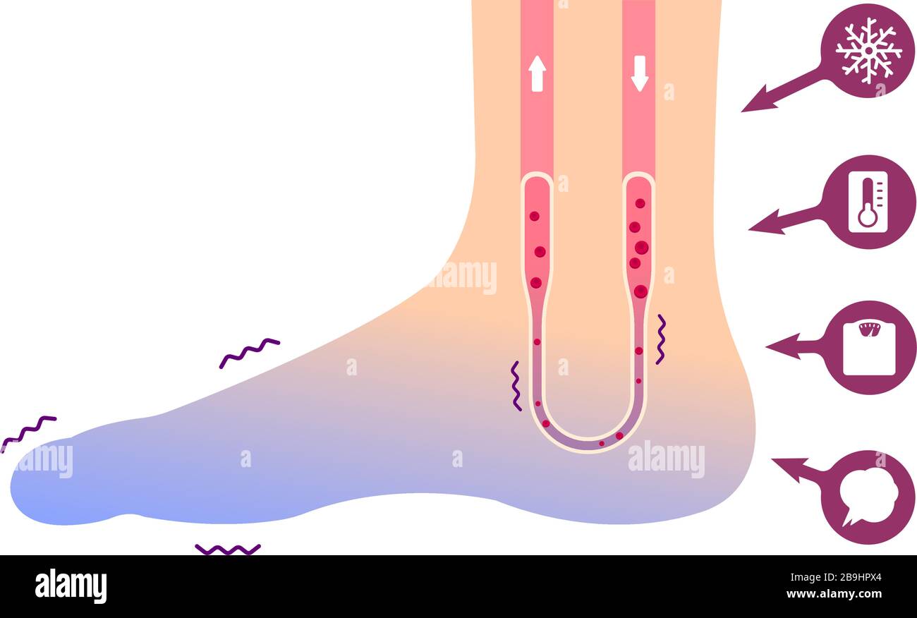 Cold foot blood circulation illustration (sensitivity to cold, cold toes) / No text Stock Vector