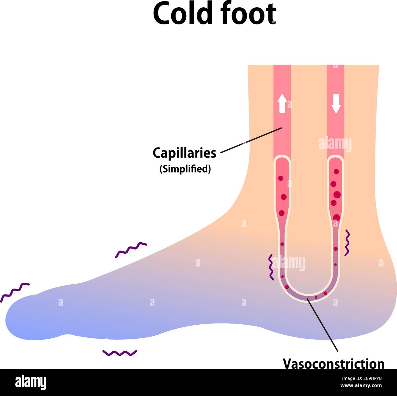 Cold foot blood circulation illustration (sensitivity to cold, cold toes Stock Vector Image