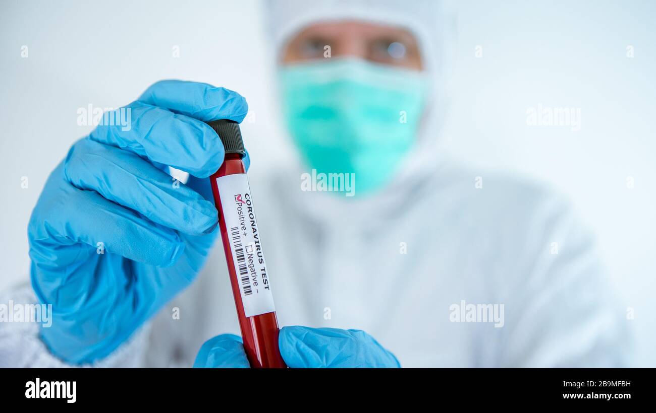 Laboratory technician man hand hold on positive blood sample tube for corona virus test , COVID-19. Scientist with protective suit and mask for protec Stock Photo