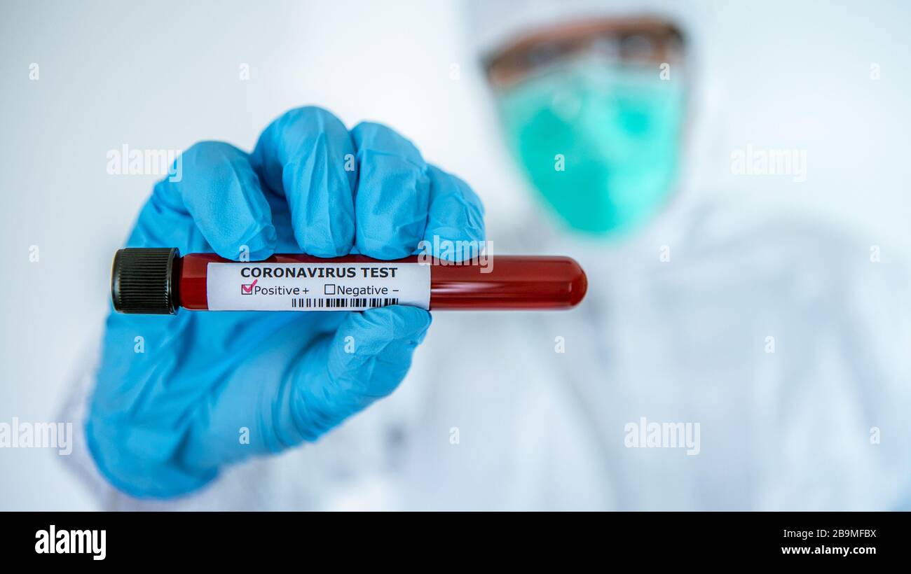 Male scientific with protective suit and positive COVID-19 test at ...