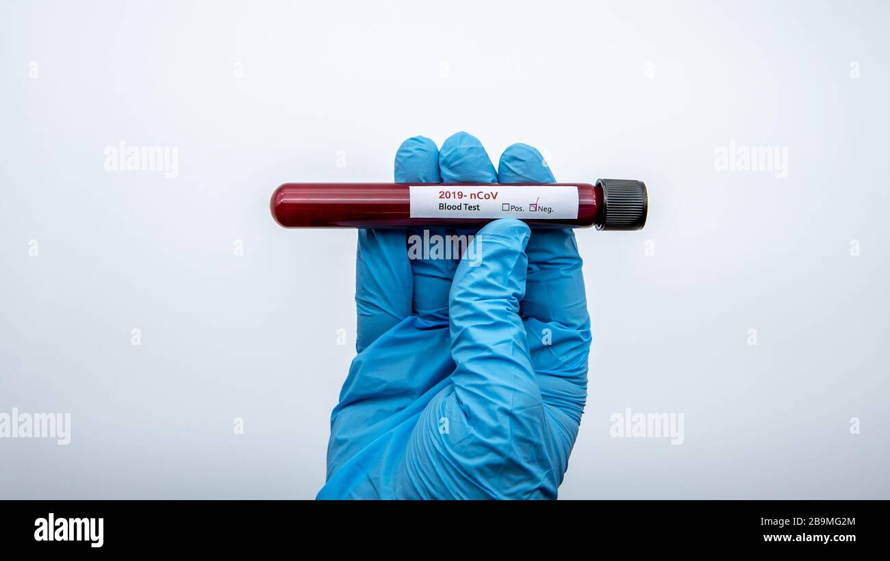 Negative COVID-19 test and laboratory sample of blood testing for diagnosis new Corona virus infection. Disease 2019 from Wuhan. Pandemic infectious c Stock Photo