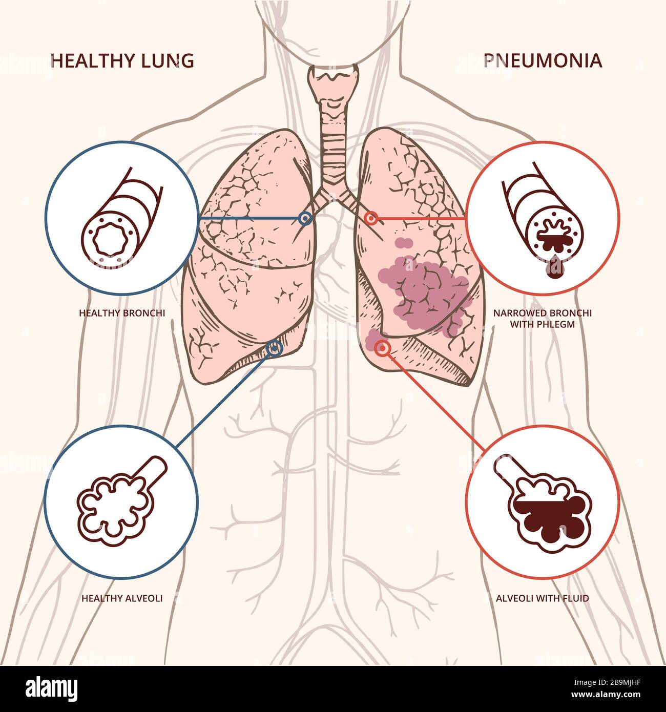 Human Lungs Infographic Stock Vector Illustration Of Infographic