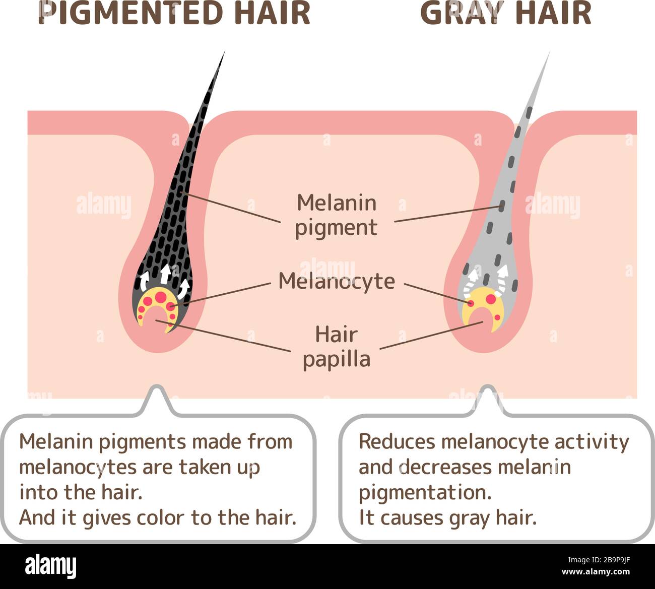 Mechanism of pigmented hair and gray hair / comparison vector illustration Stock Vector