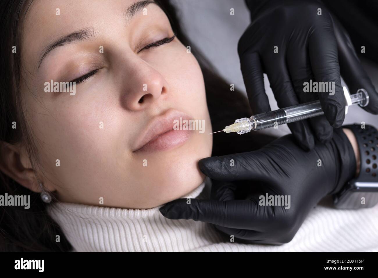 Injections of the lips. Adjustment of the lower lip form. Injection of ...