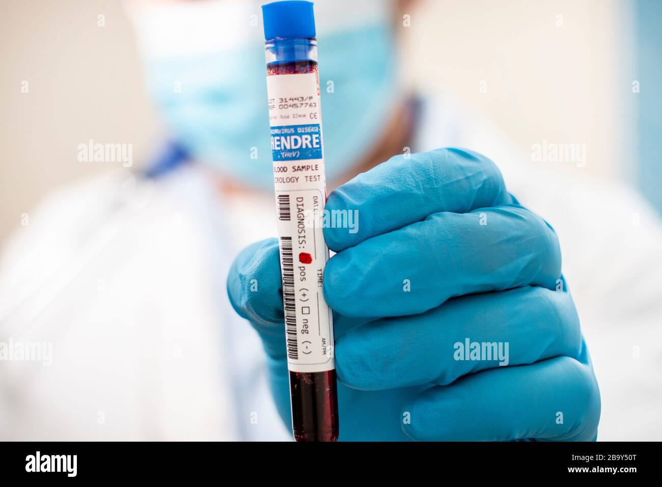 View of a doctor holding a fictional test tube blood sample, infected with hendre virus. Stock Photo