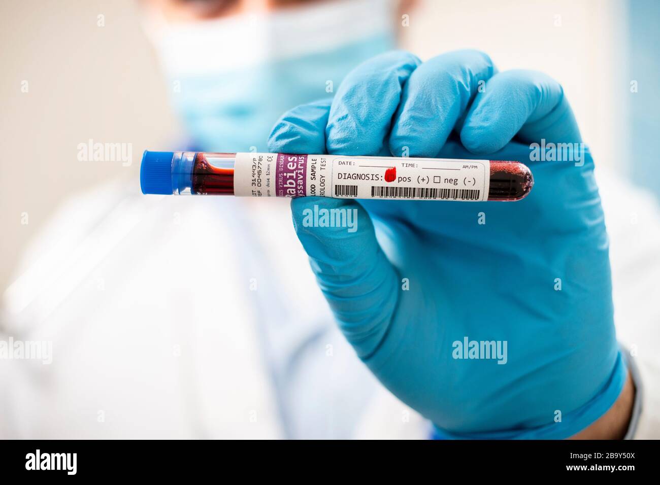 View of a doctor holding a fictional test tube blood sample, infected with rabies virus. Stock Photo
