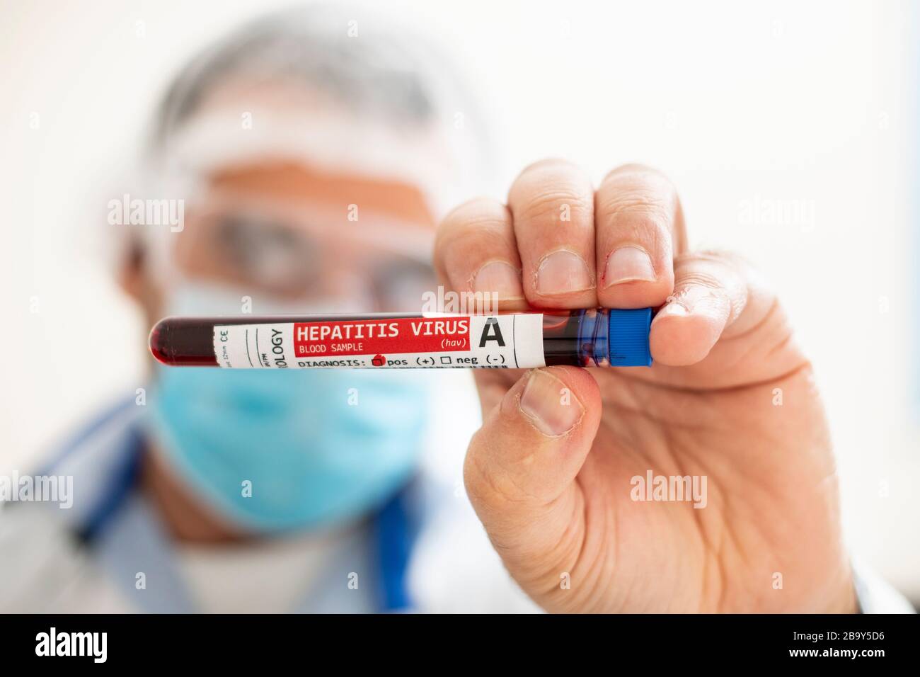 Hepatitis A Virus High Resolution Stock Photography And Images Alamy Hepatitis A Virus High Resolution Stock Photography And Images Alamy