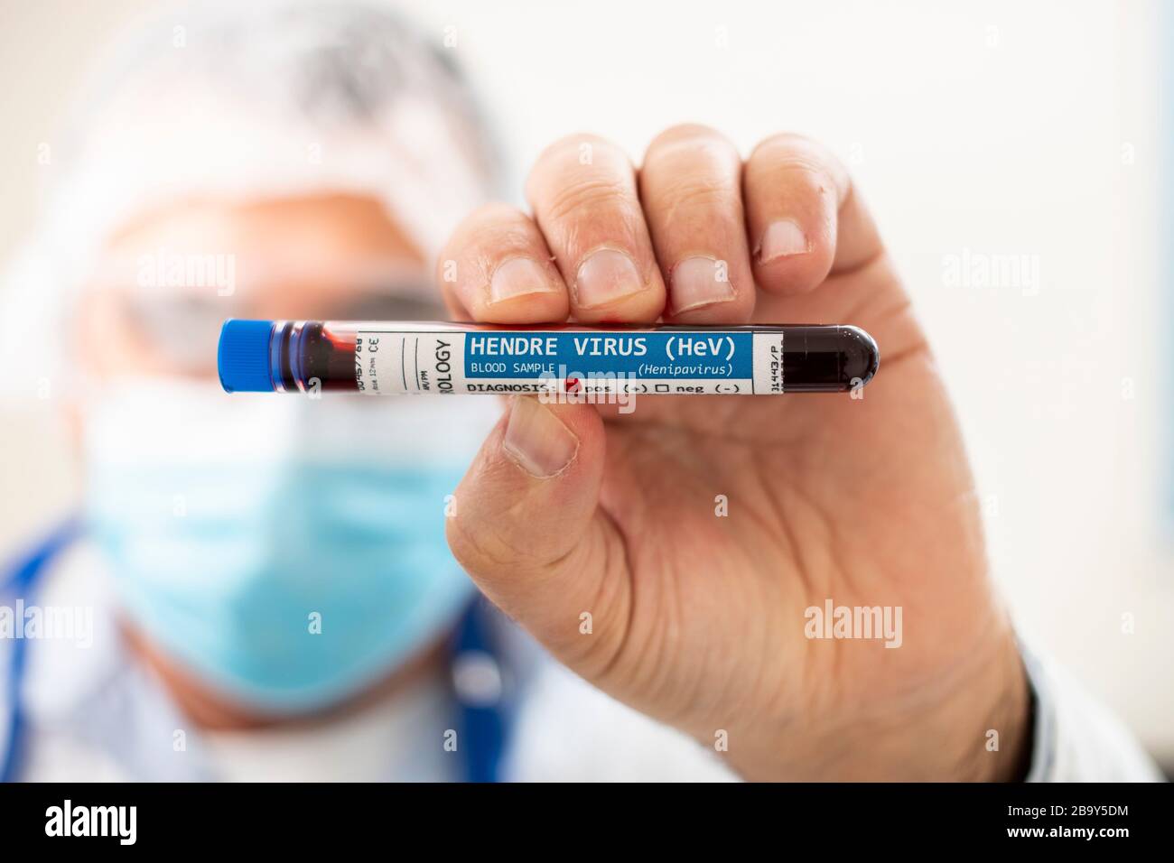 View of a doctor holding a fictional test tube blood sample, infected with Hendre virus. Stock Photo