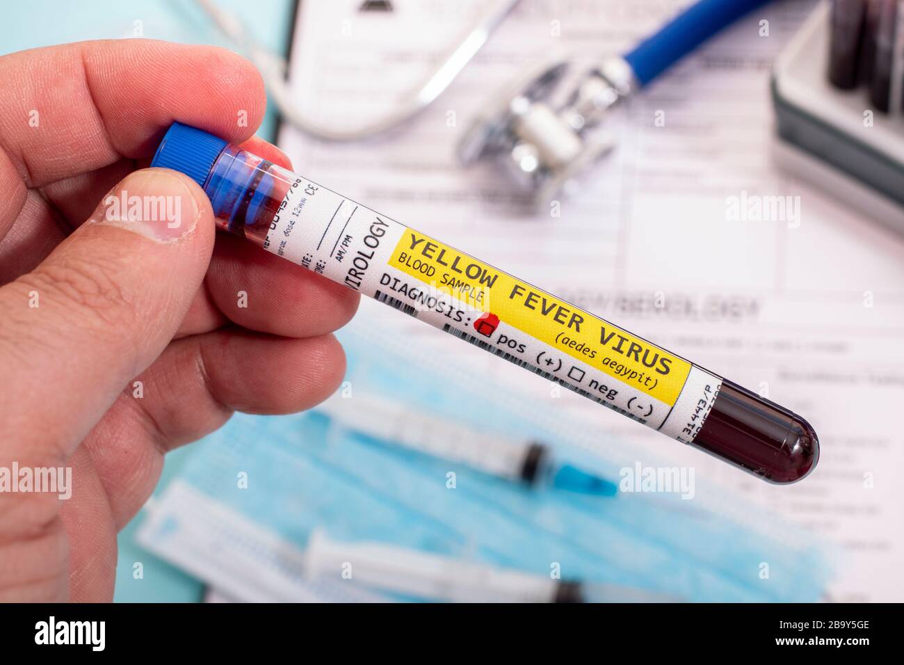 Fictional Blood samples with infected yellow fever virus, with ...