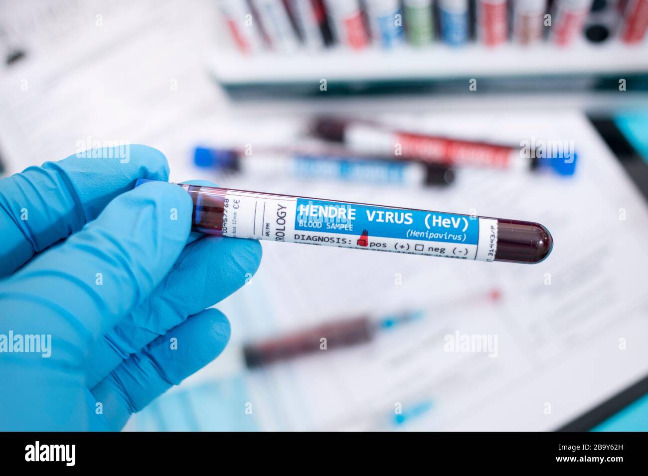 Fictional Blood samples with infected hendre virus, with stethoscope, mask and syringe and other stuff. Stock Photo