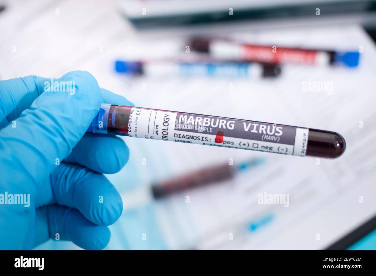 Fictional Blood samples with infected marburg virus, with stethoscope, mask and syringe and other stuff. Stock Photo