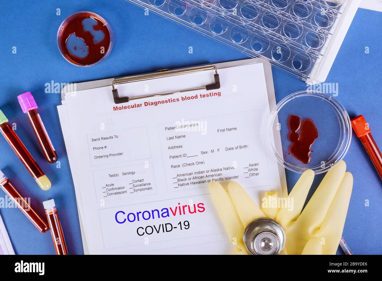 Covid19 coronavirus with blood sample Pipette adding fluid of