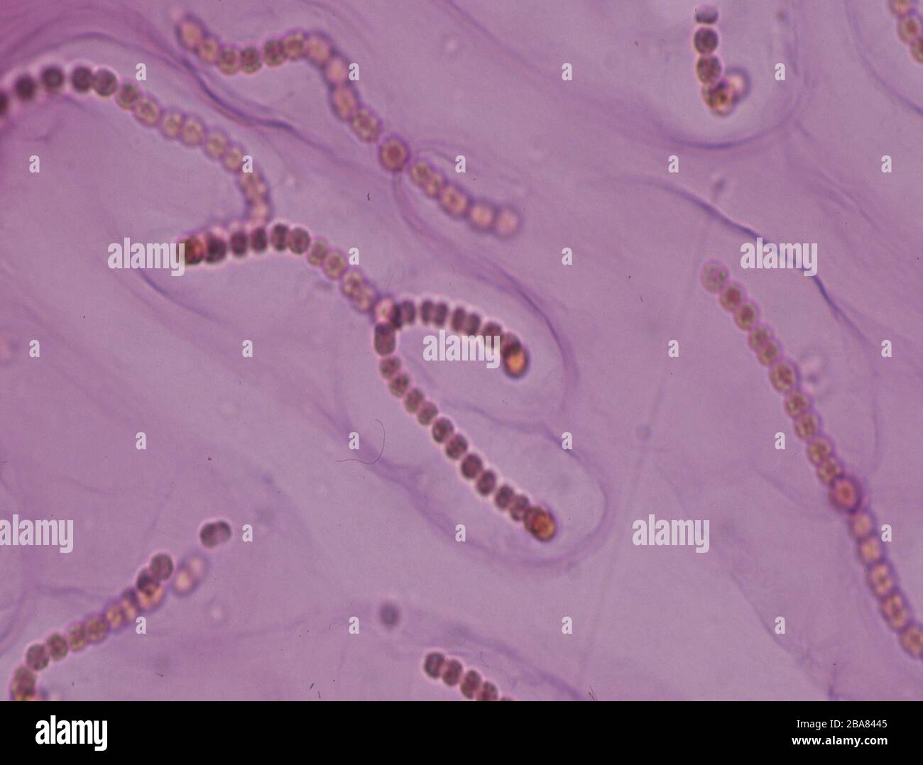 Red algae under the microscope 100x Stock Photo - Alamy