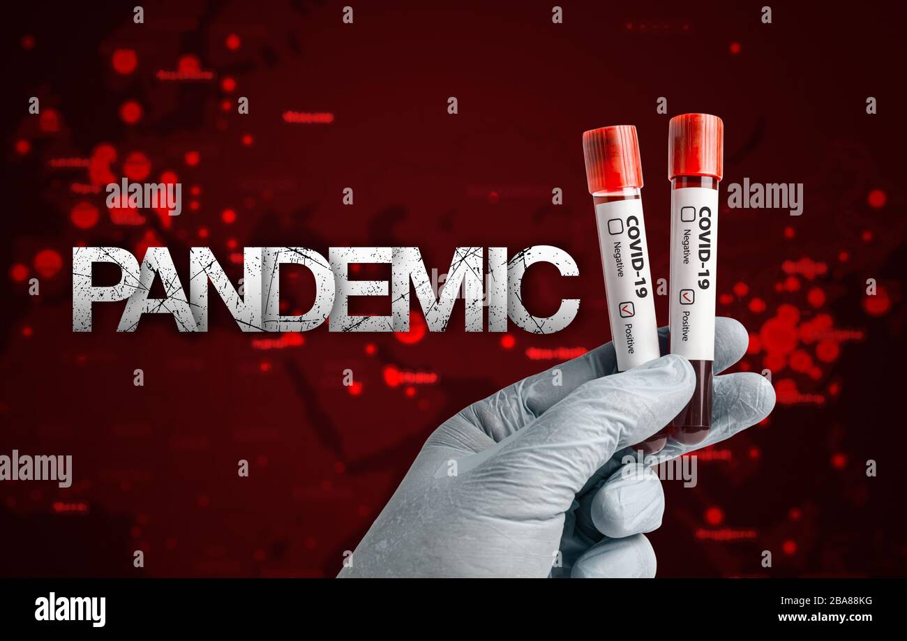 Pandemic COVID-19 concept: Scientist holding blood sample in test tubes with positive test result marked.  Pandemic message in  front of blurred Europ Stock Photo