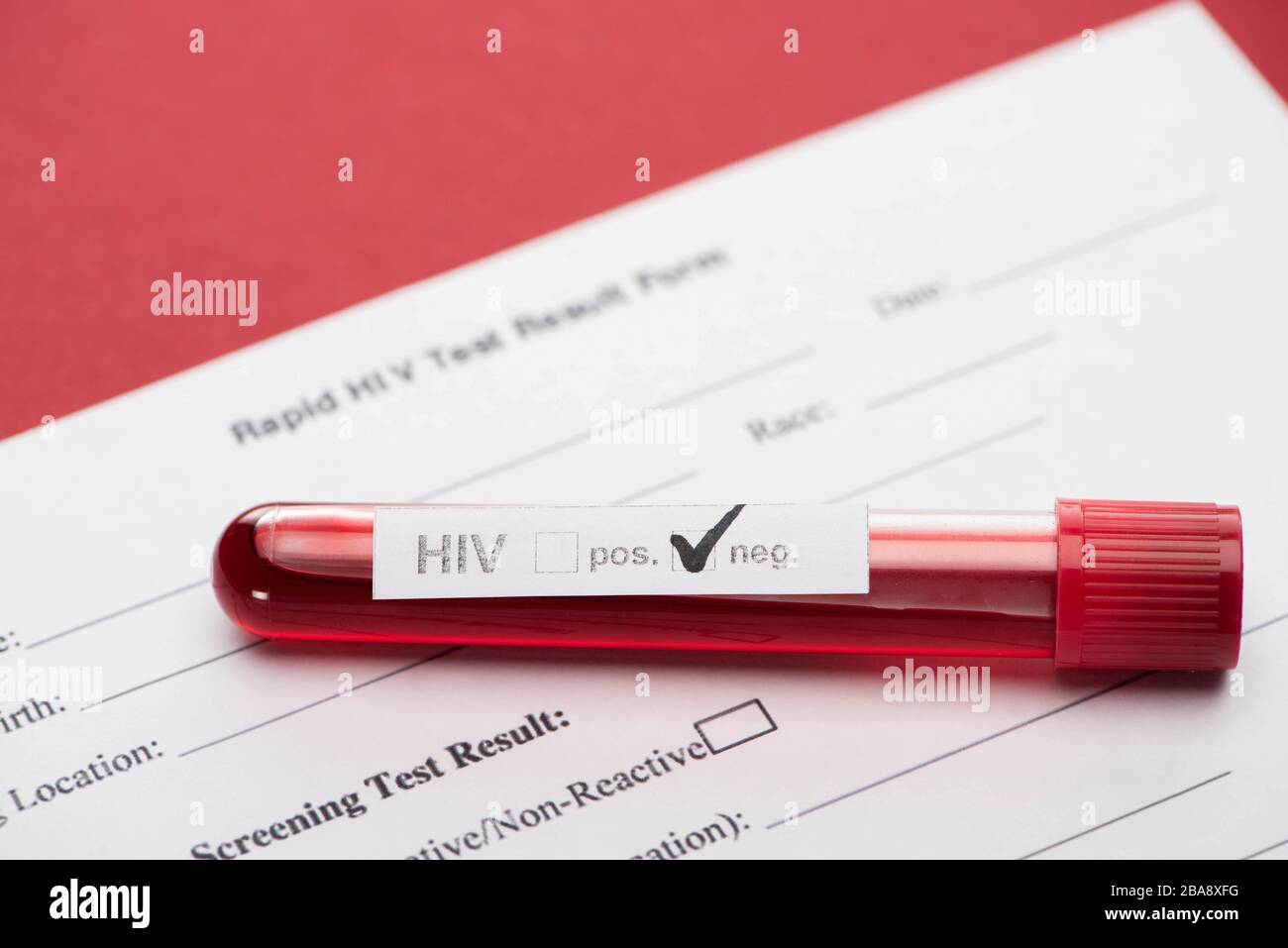 Rapid HIV Test Result Form With Negative Hiv Blood Sample Test On Red 