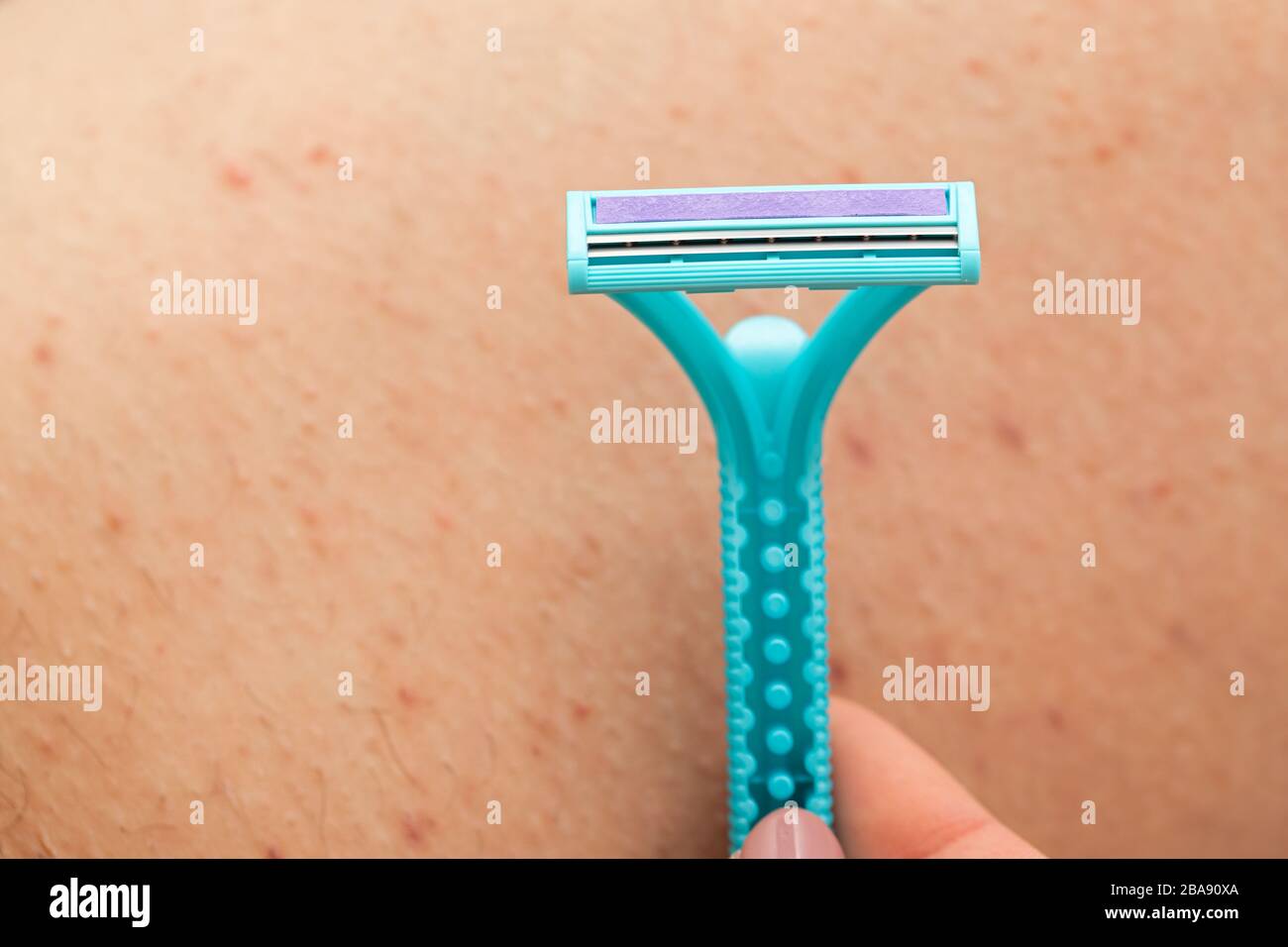 Как правильно брить интимную зону мужчине бритвой. Раздражение кожи после бритья. Раздражение после бритья на ногах. Раздражение после бритвы.