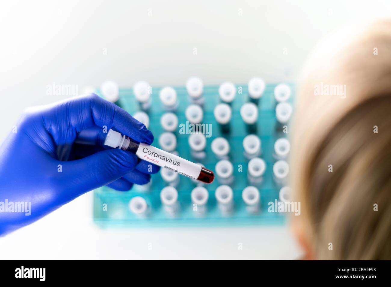 A young person looking at test-tube indicating positive results of coronavirus test hold by health worker. Stock Photo