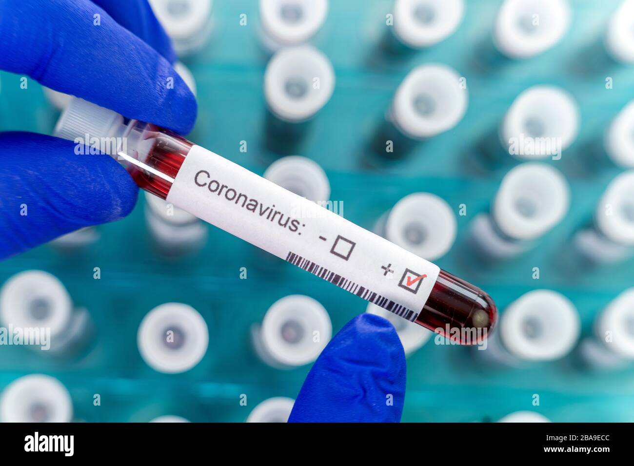 Health worker holds one testtube and indicates positive results of