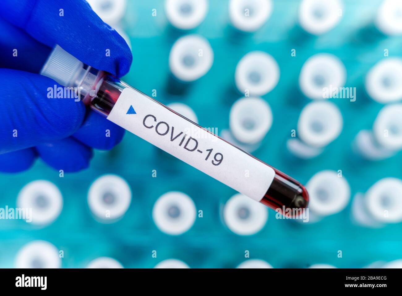 Positive results of corona virus tests. Many blood test tube in special