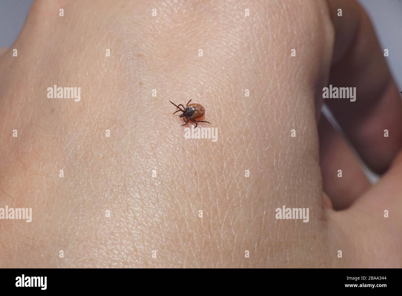 Female tick ( Ixodes scapularis) crawling on skin ready to bite Stock Photo