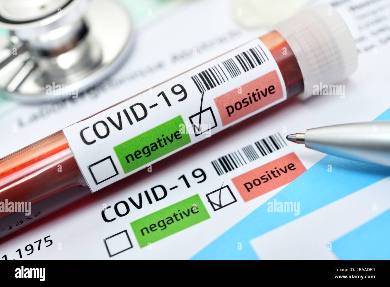 Blood test with positive Covid 19 findings, symbolic photo Coronavirus, Blutprobe mit positivem Covid-19-Befund, Symbolfoto Coronavirus Stock Photo