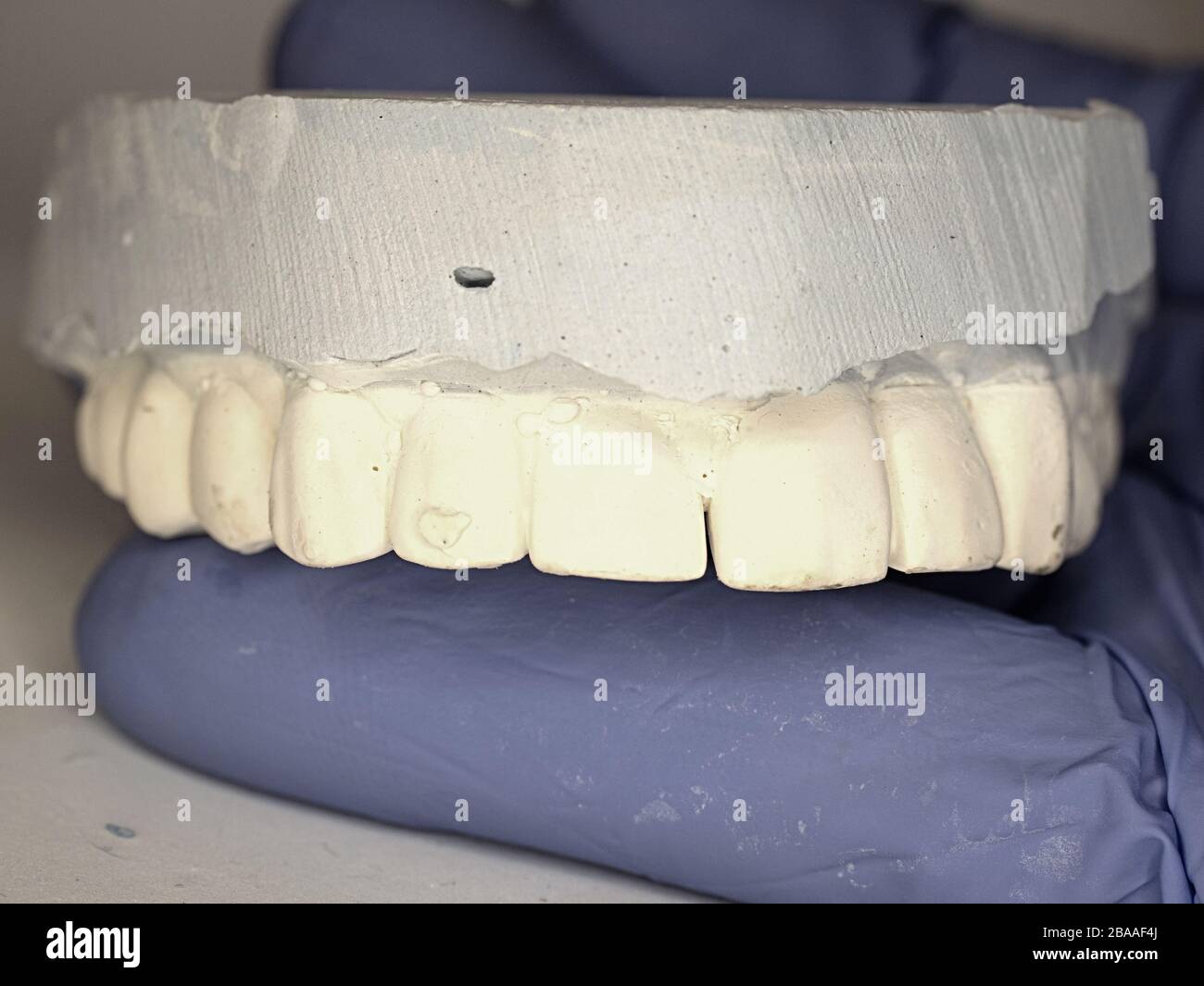 Dentist hold in fingers dental gypsum model. Dentist laboratory office