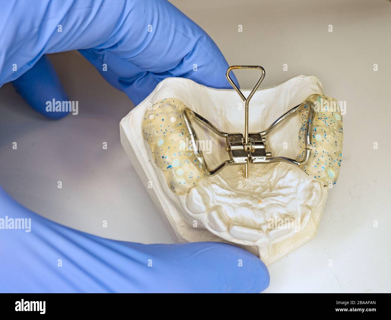 Dentist setting in fingers patient teeth model with Hyrax Expander