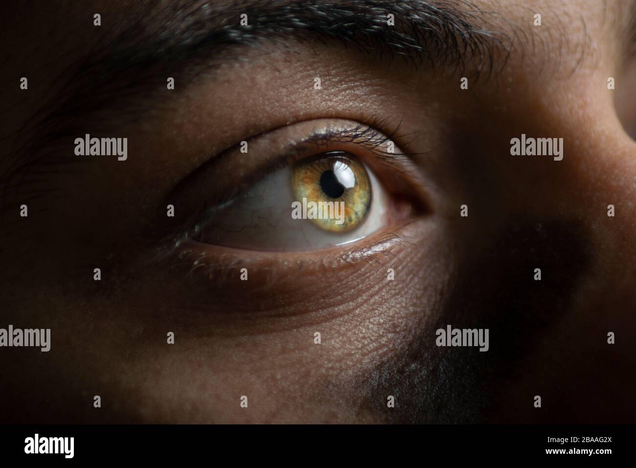 Alexandria, Egypt march 26, 2020 man's eye with nevus spongiosus albus mucosae with catch light of octabox Stock Photo