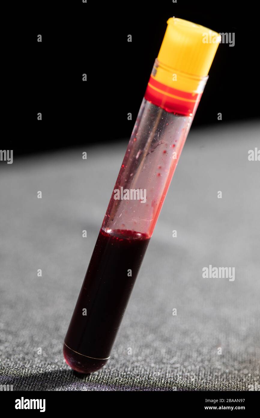 Each blood vial is transported to the laboratory for specialized tests Stock Photo Alamy
