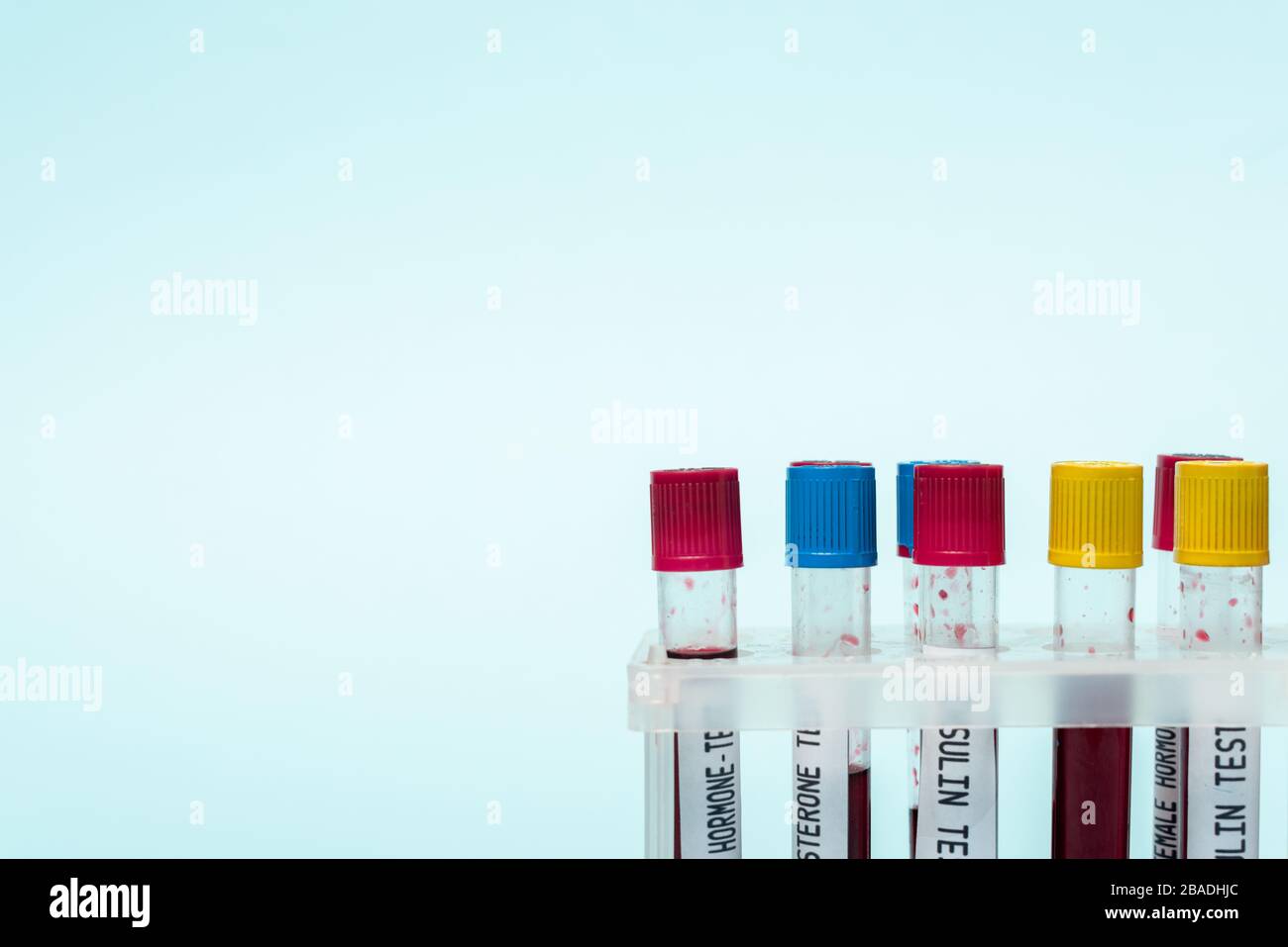 Test tubes with blood samples of hormones tests in stand isolated on