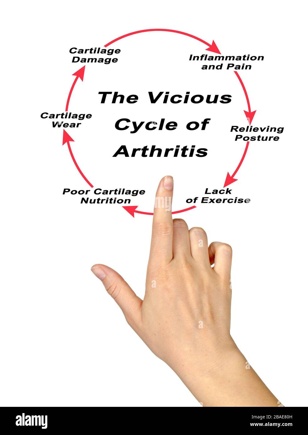Steps in Vicious Cycle of Arthritis Stock Photo - Alamy