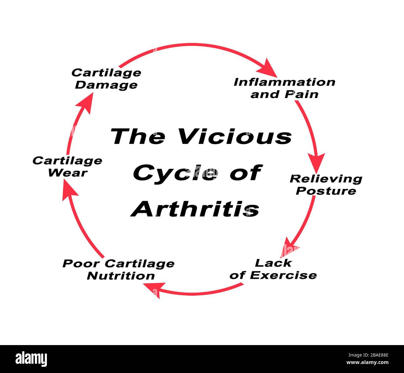 Steps in Vicious Cycle of Arthritis Stock Photo Alamy