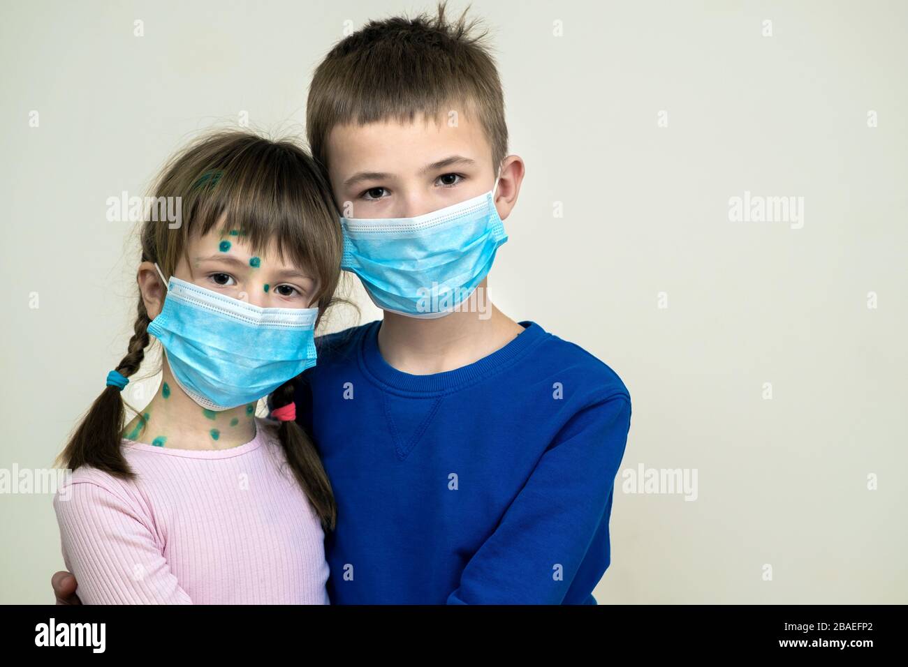 Boy and girl wearing blue protective medical mask ill with chickenpox