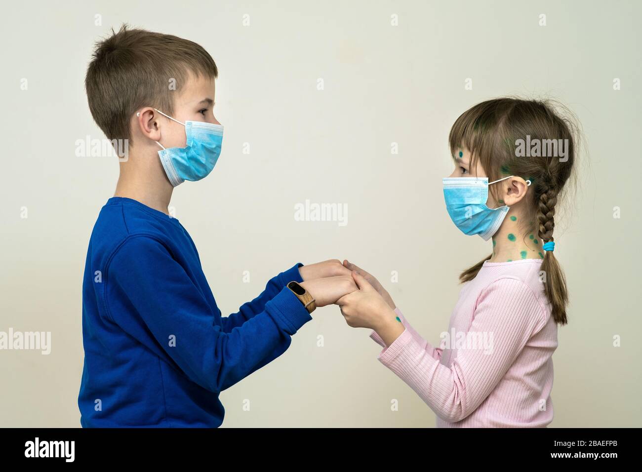 Boy and girl wearing blue protective medical mask ill with chickenpox, measles or rubella virus with rashes on body. Children protection during epidem Stock Photo