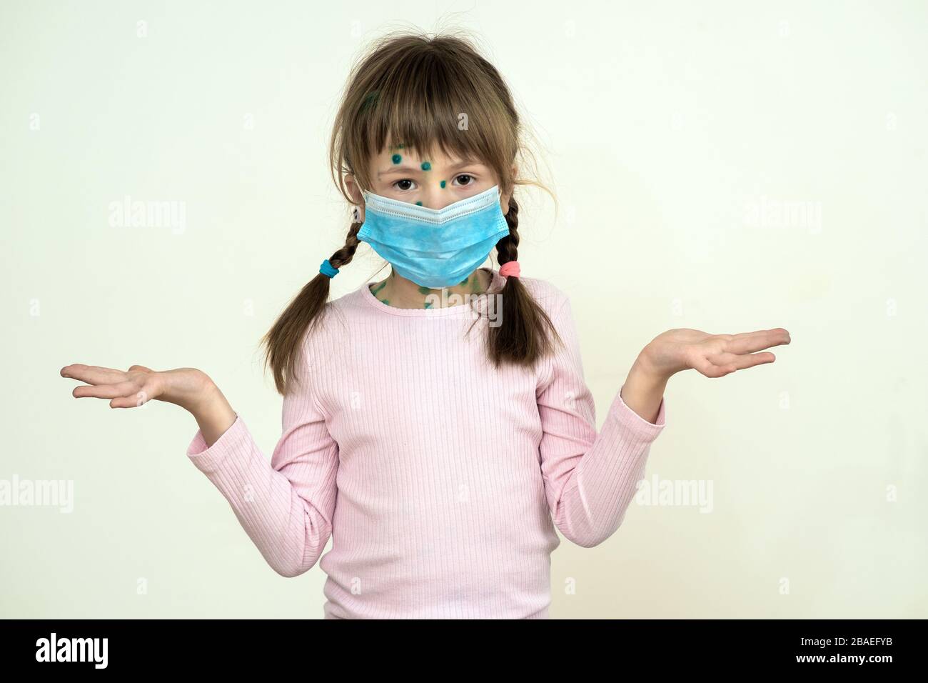 Child girl wearing blue protective medical mask ill with chickenpox, measles or rubella virus with rashes on body. Children protection during epidemic Stock Photo